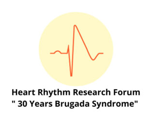 30 Years Brugada Syndrome